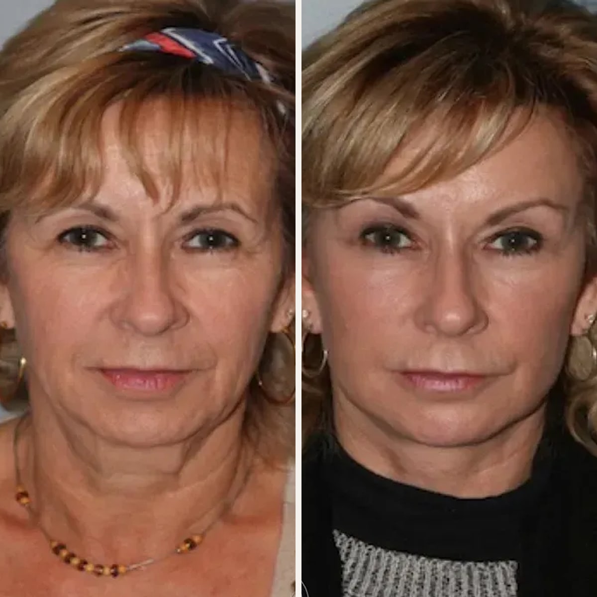 Before and after: Dr. Jed Horowitz