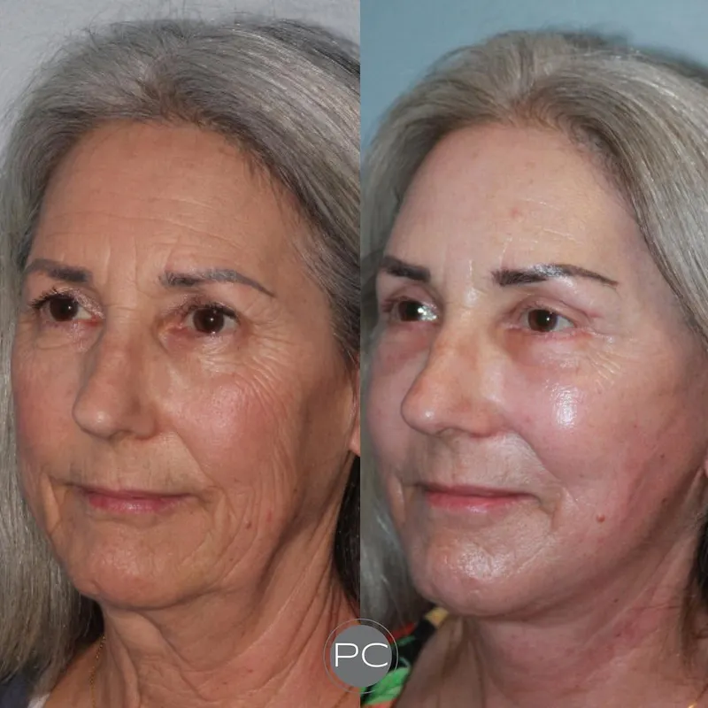 Before and after: Dr. Jed Horowitz