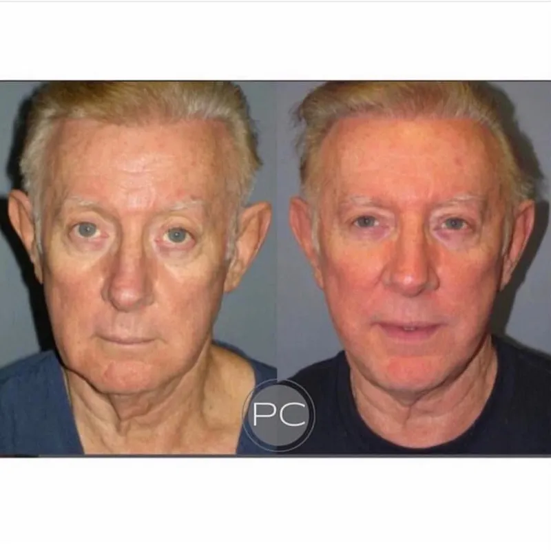 Before and after: Dr. Jed Horowitz