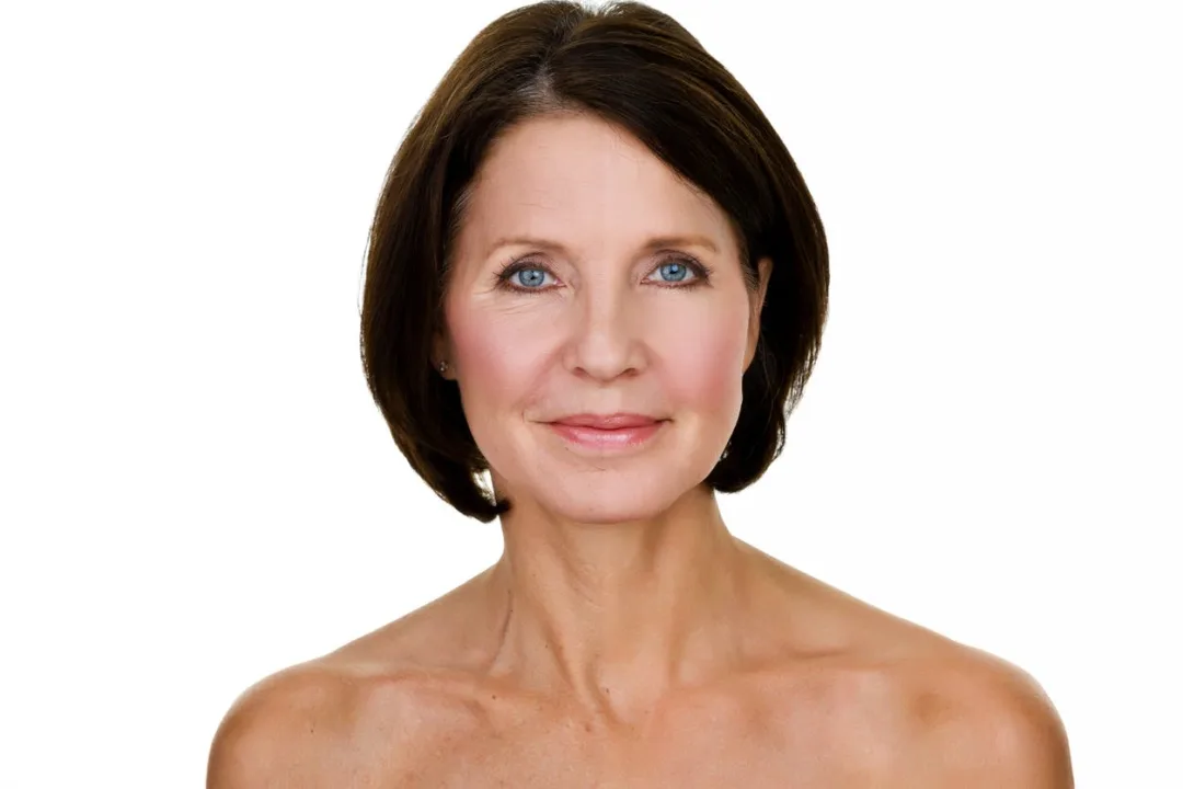 Before and after deep plane facelift — 58-year-old woman, frontal view, 7mo post-op by Dr. Jeffrey Spiegel
