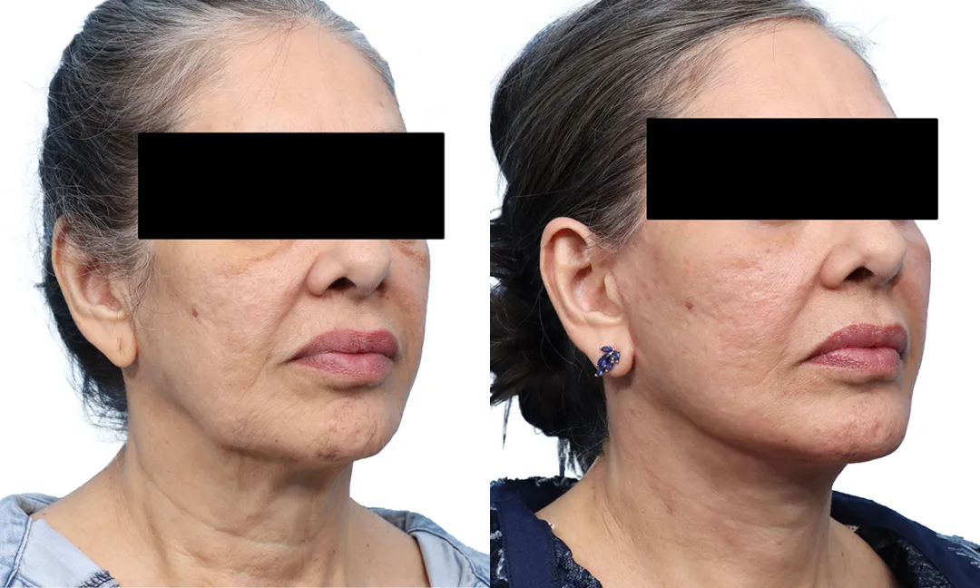 Before and after — Dr. Jeffrey Wise