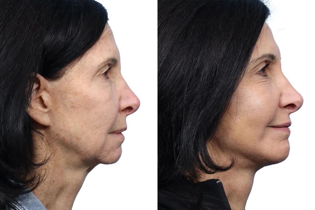 Before and after — Dr. Jeffrey Wise
