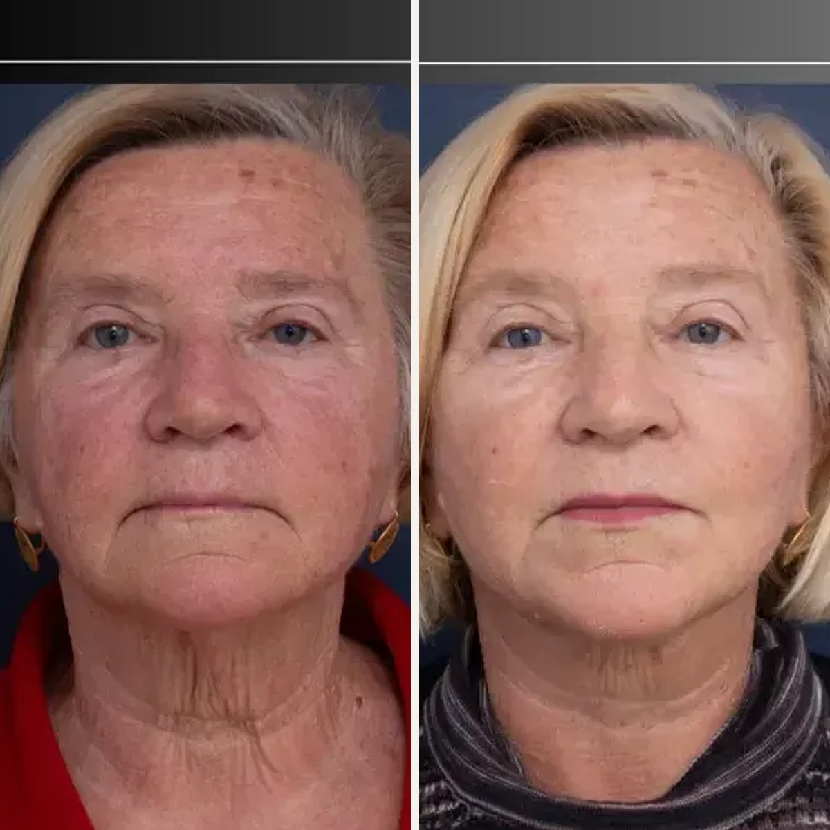 Before and after: Dr. Jeremy Hunt