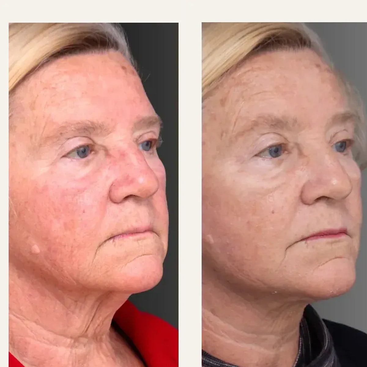 Before and after: Dr. Jeremy Hunt