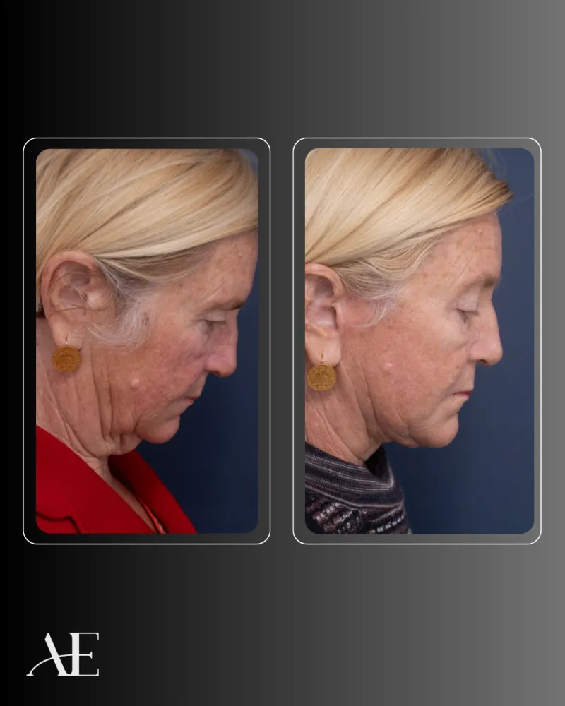 Before and after: Dr. Jeremy Hunt