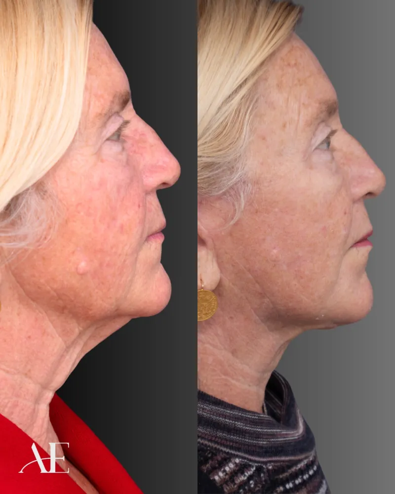 Before and after: Dr. Jeremy Hunt