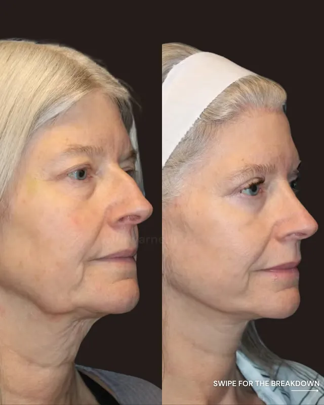 Before and after — Dr. Jeremy Warner