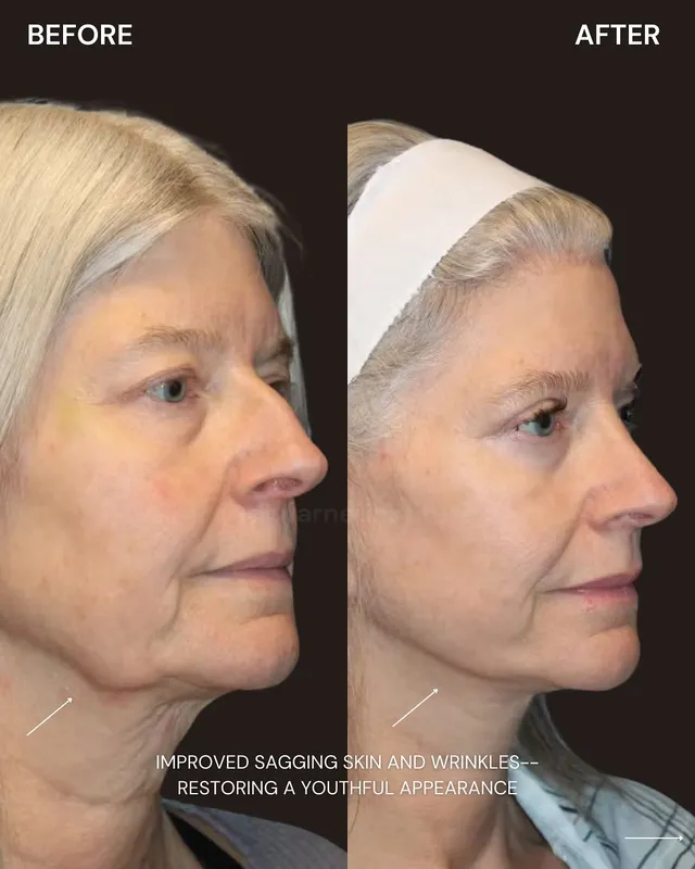 Before and after — Dr. Jeremy Warner