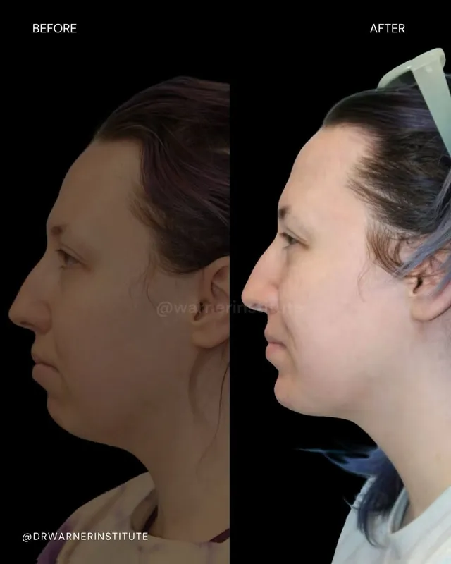 Before and after — Dr. Jeremy Warner