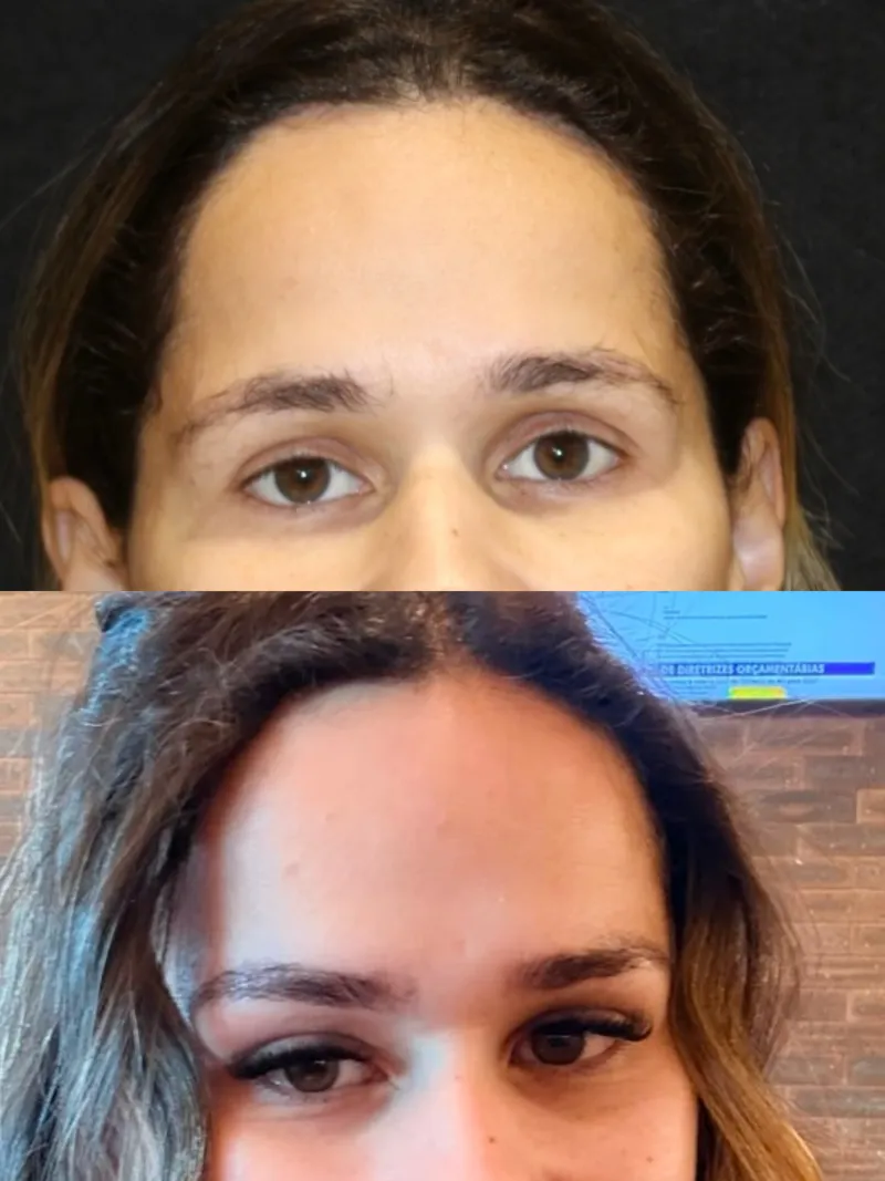 Before and after: Dr. João Ilgenfritz Neto