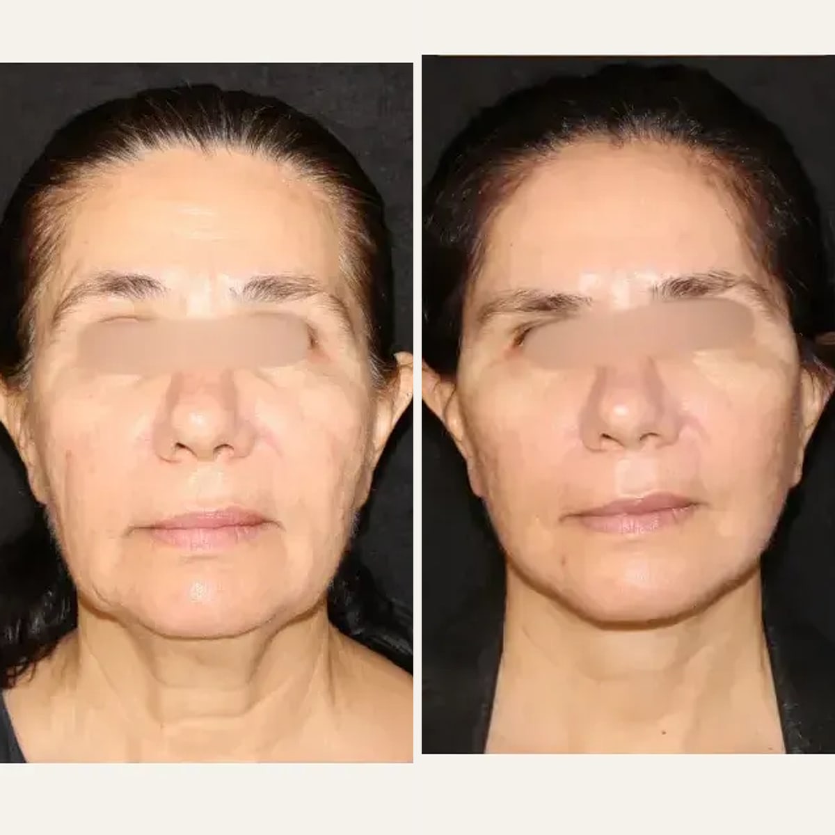Before and after: Dr. João Ilgenfritz Neto