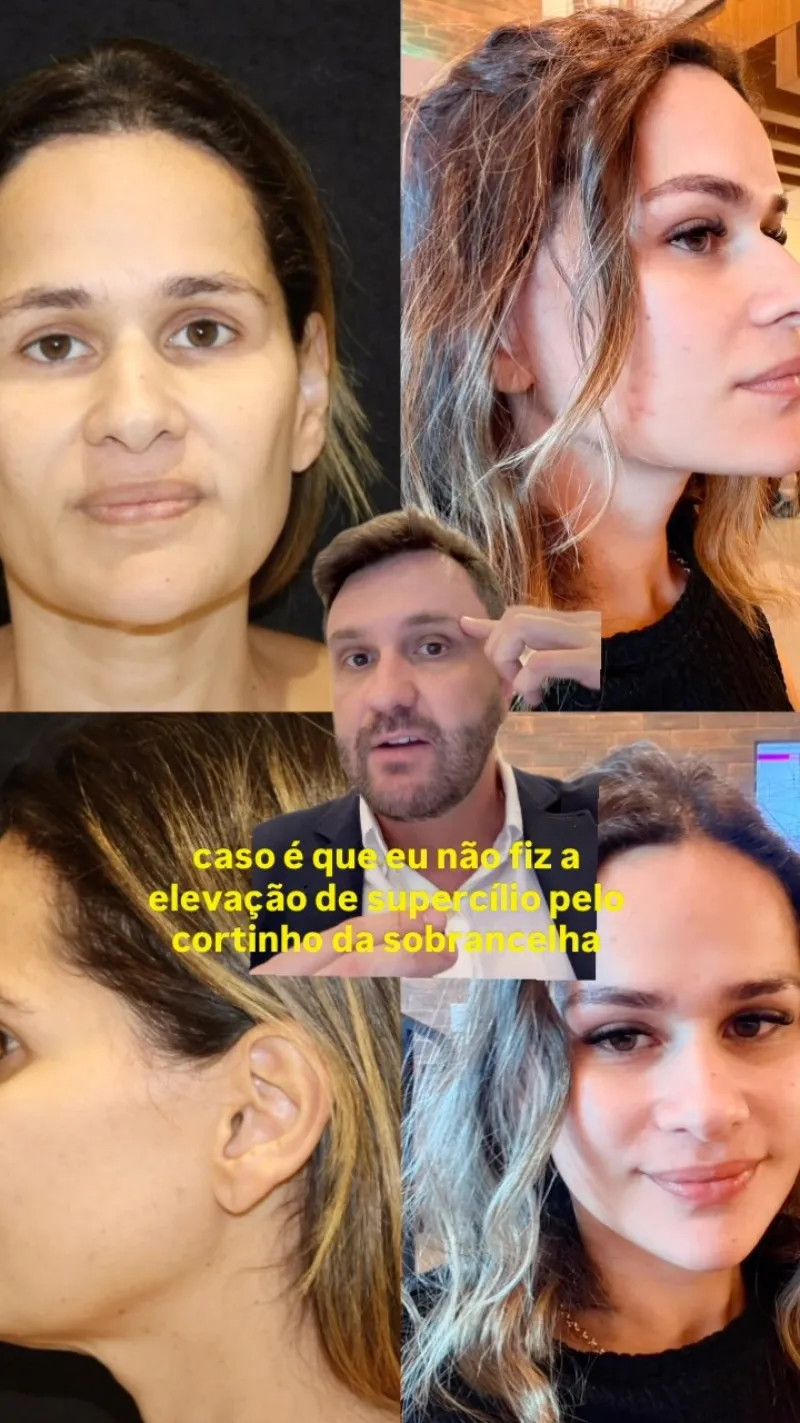 Before and after: Dr. João Ilgenfritz Neto