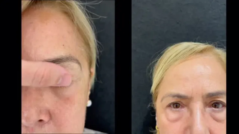 Before and after: Dr. João Ilgenfritz Neto