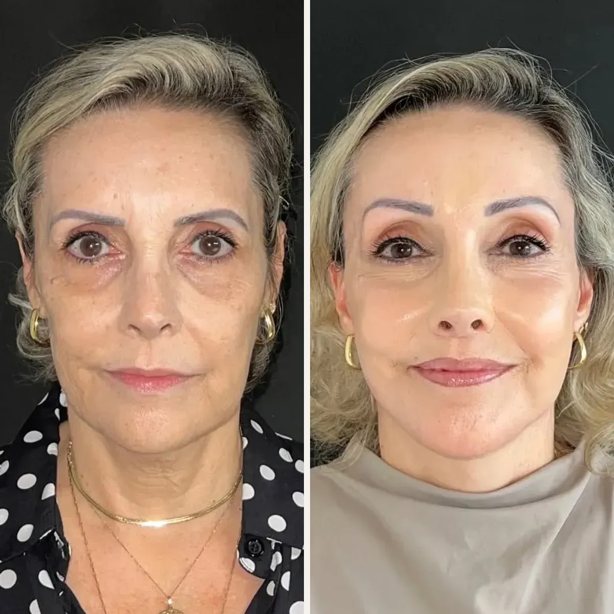 Before and after: Dr. Joao Zanirati