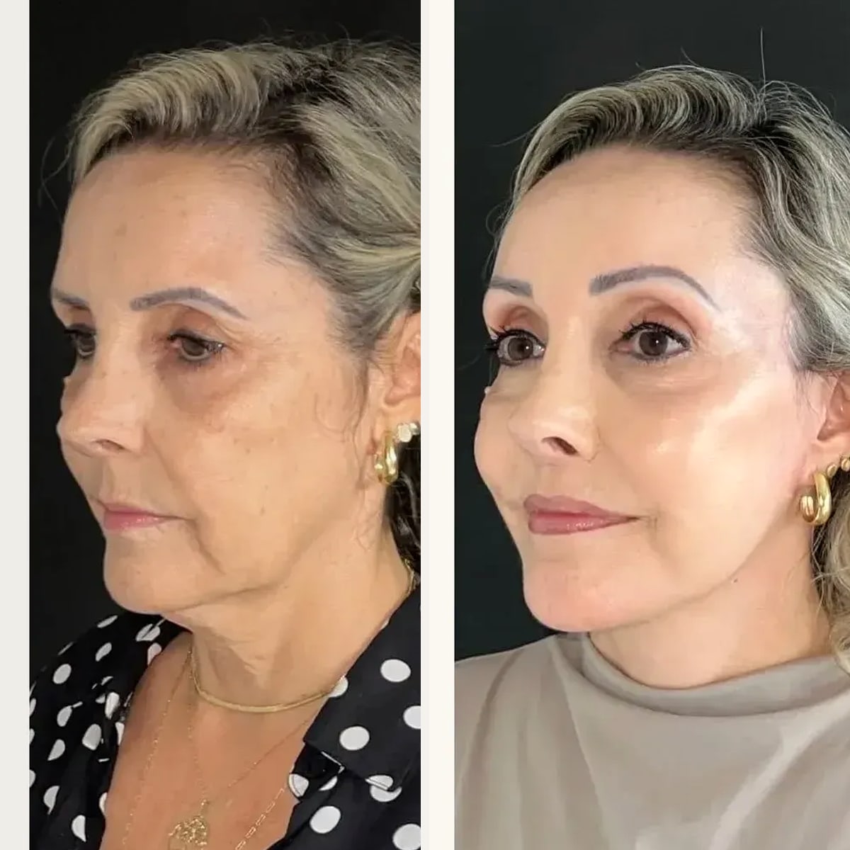 Before and after: Dr. Joao Zanirati