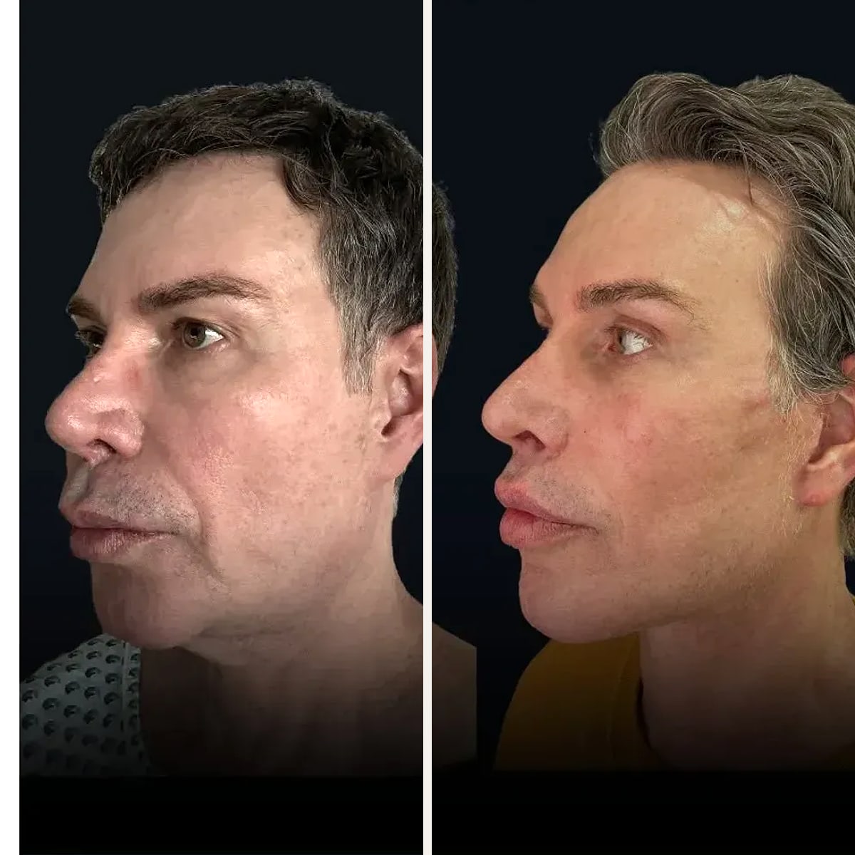 Before and after: Dr. Joel Abdala