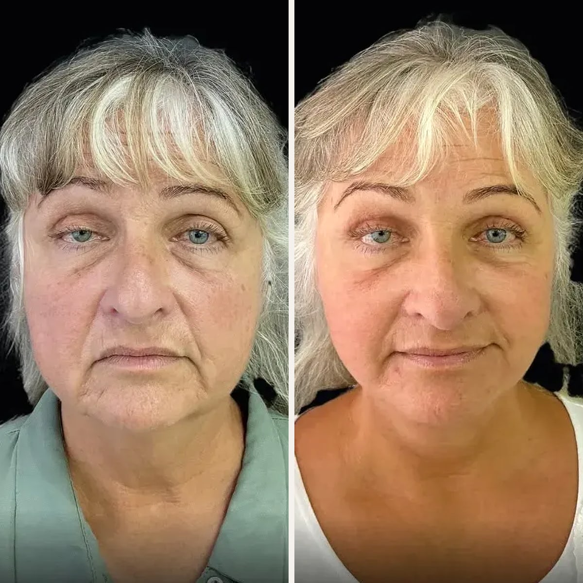Before and after: Dr. Joel Abdala