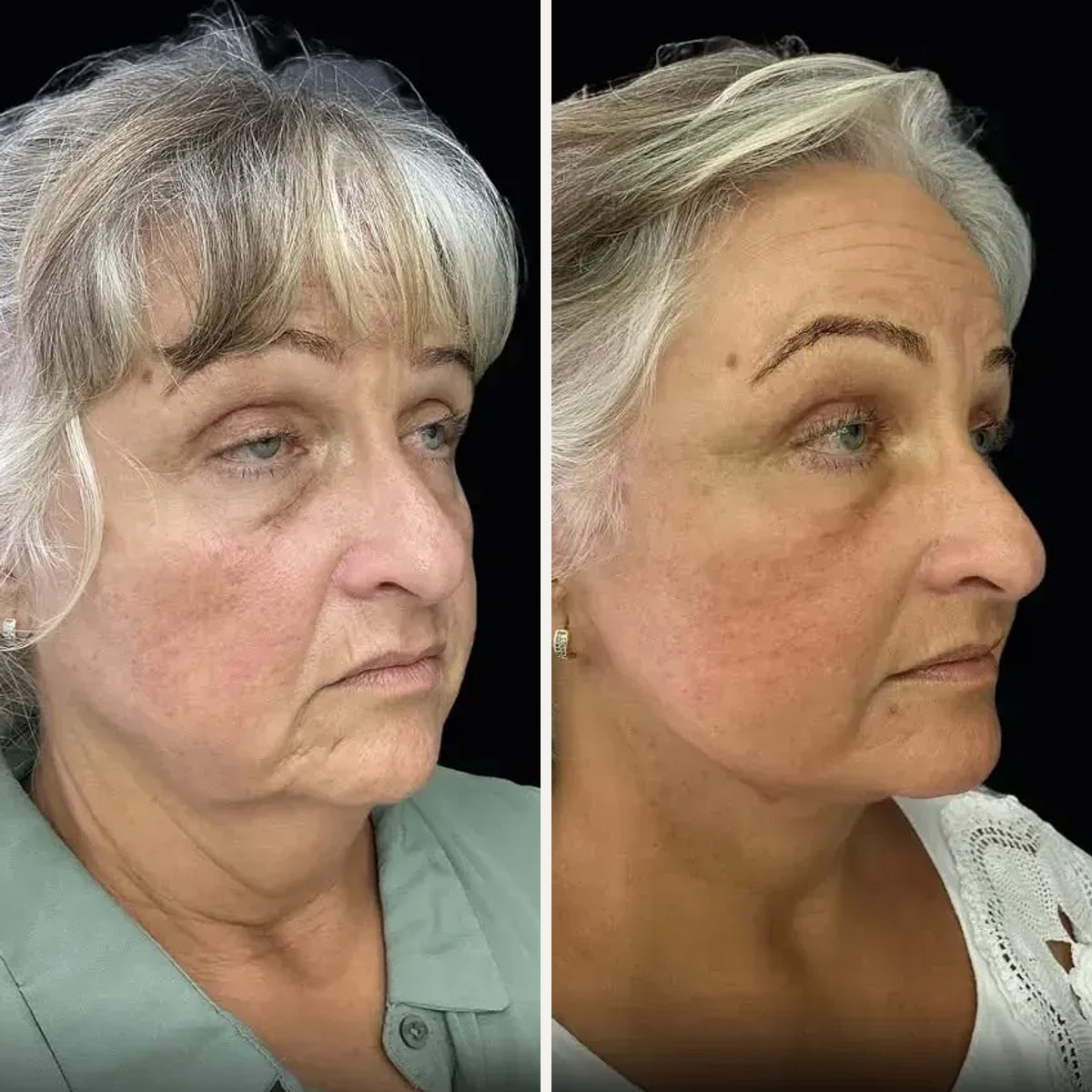 Before and after: Dr. Joel Abdala