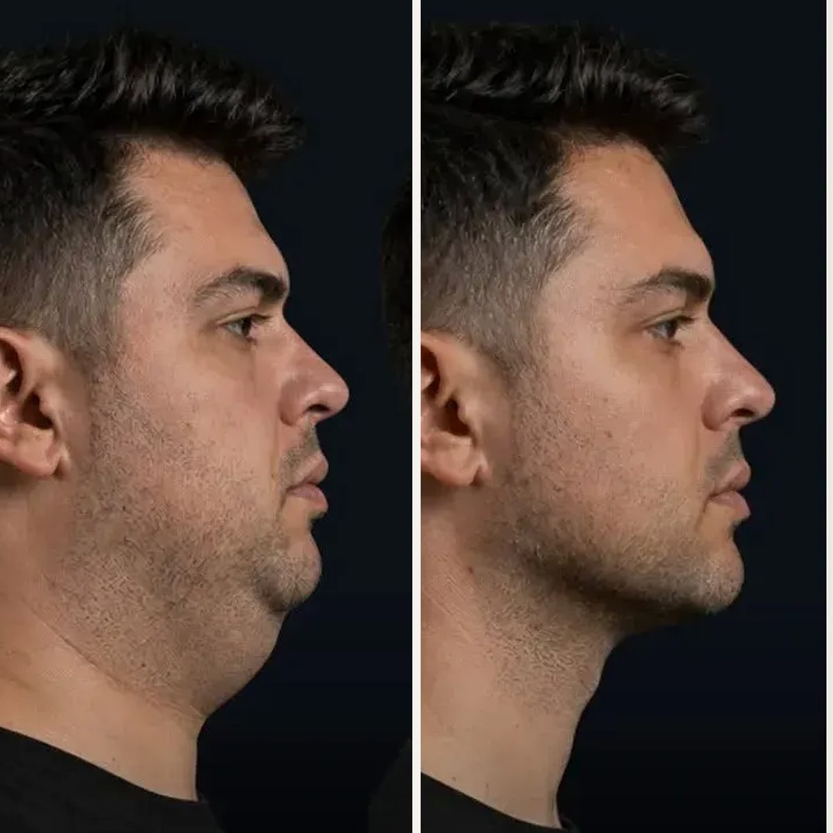 Before and after: Dr. Joel Abdala