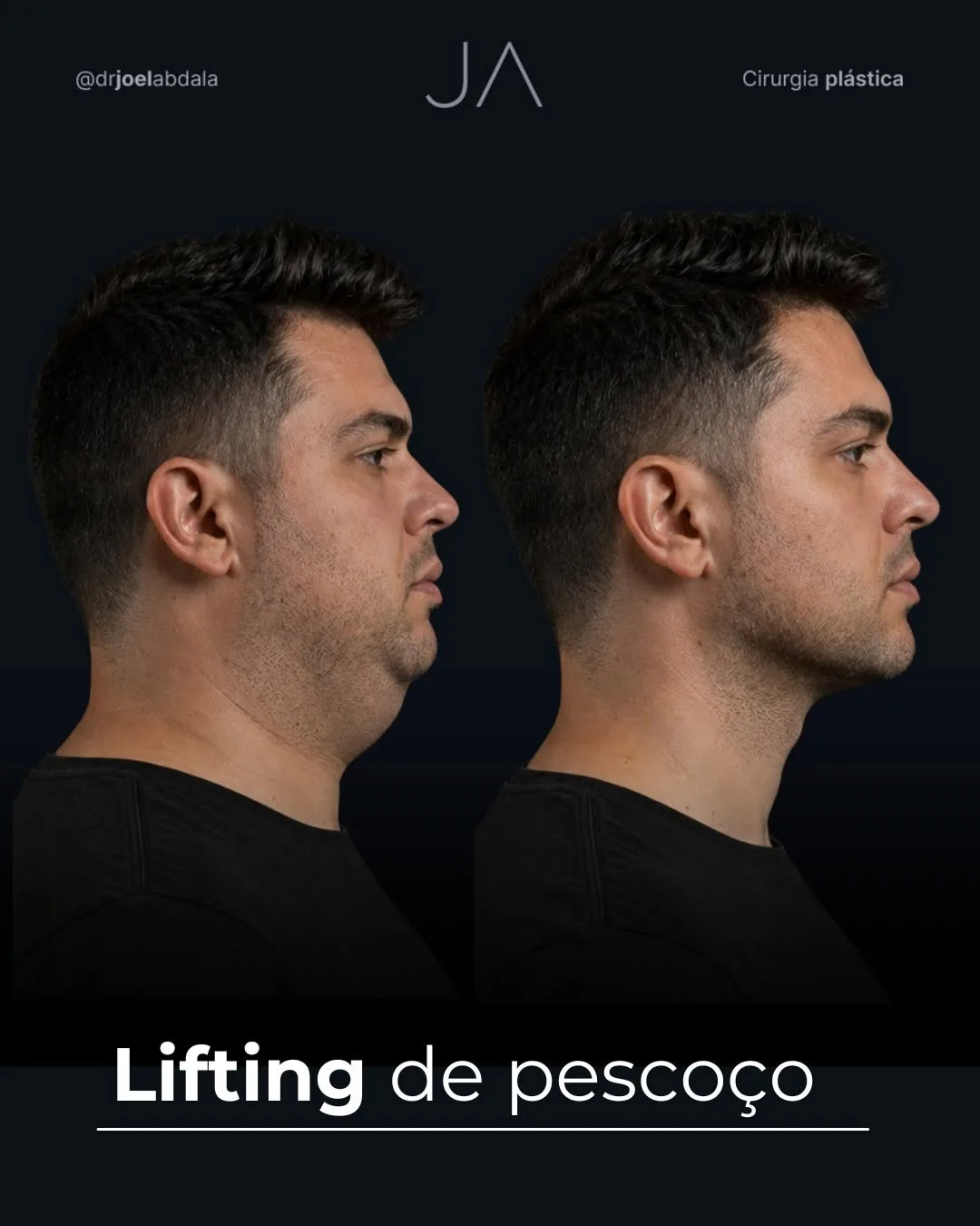 Before and after — Dr. Joel Abdala