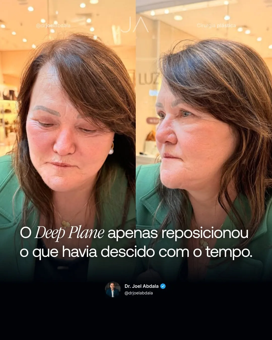 Before and after — Dr. Joel Abdala