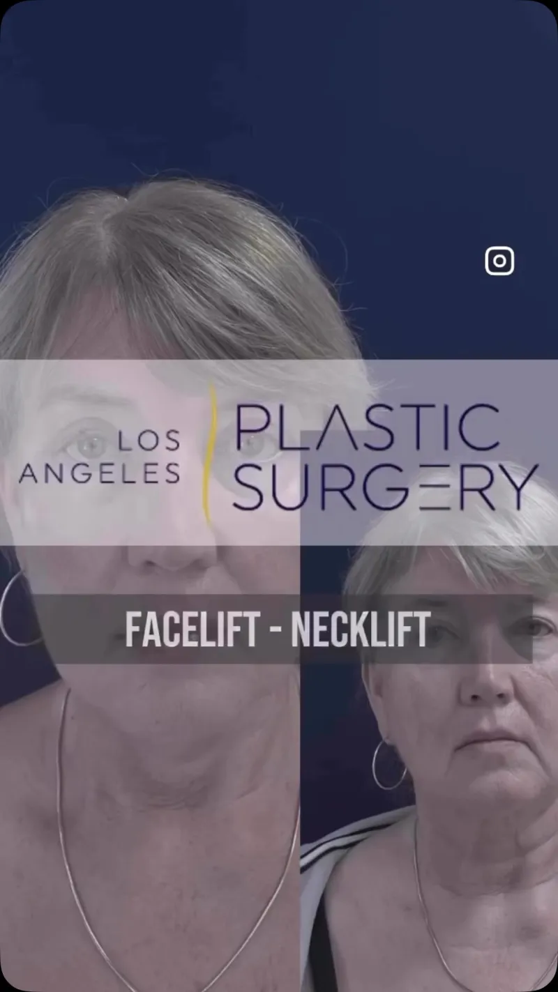 Before and after: Dr. John Anastasatos
