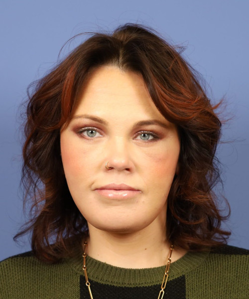 After deep plane facelift — 45-year-old woman, frontal view, 3mo post-op by Dr. John Bitner