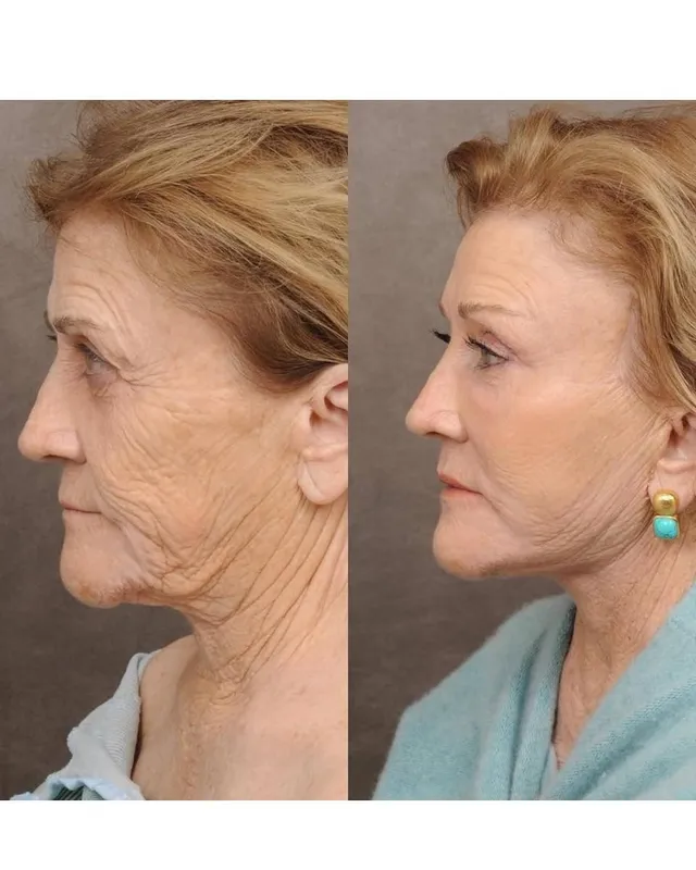 Before and after — Dr. John Holds