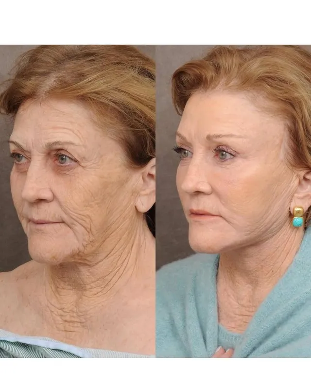 Before and after — Dr. John Holds