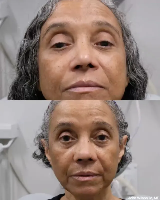 Before and after — Dr. John Wilson IV