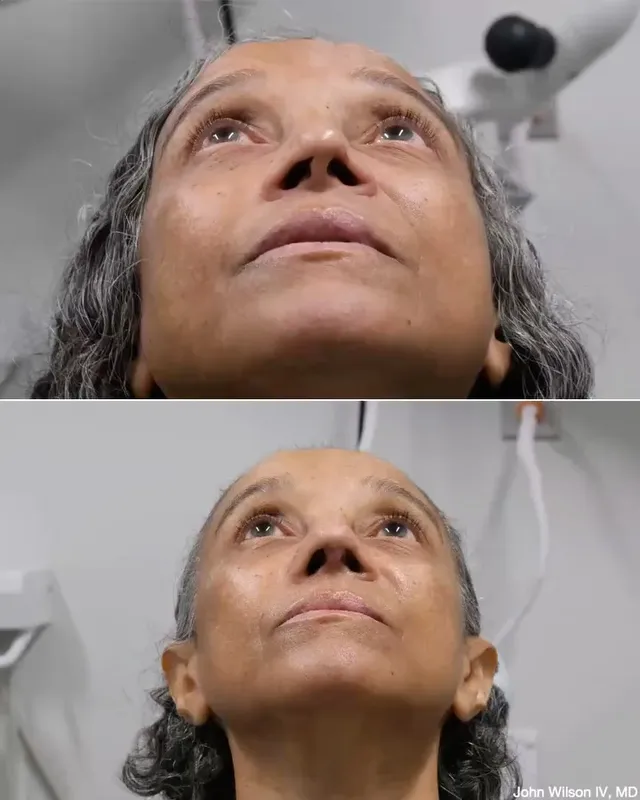 Before and after — Dr. John Wilson IV