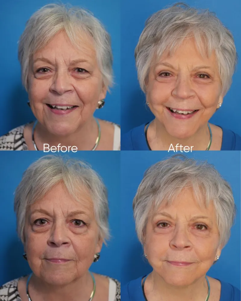 Before and after — Dr. Jon Mendelsohn