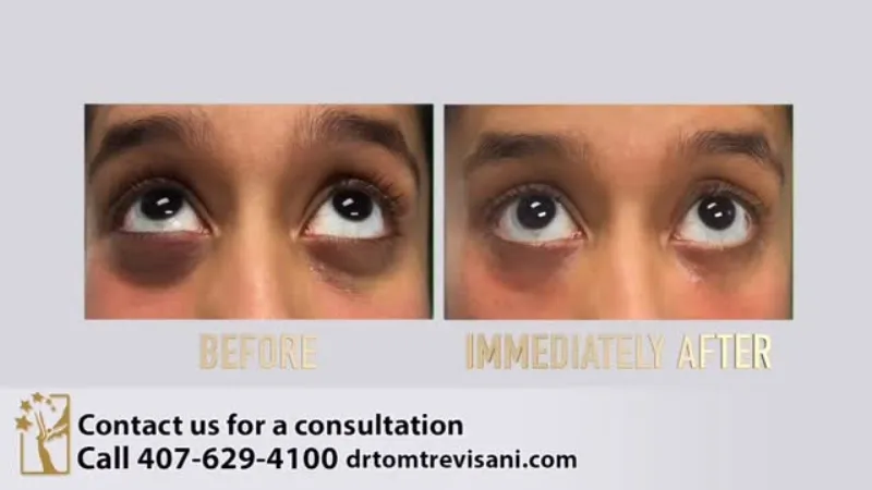 Before and after: Dr. Jon Trevisani