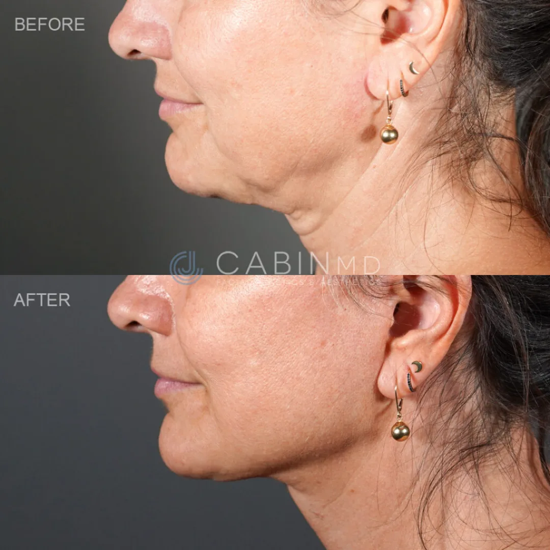 Before and after — Dr. Jonathan Cabin