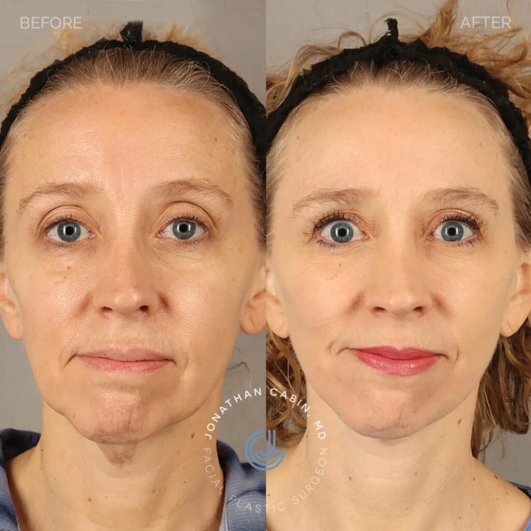 Before and after — Dr. Jonathan Cabin