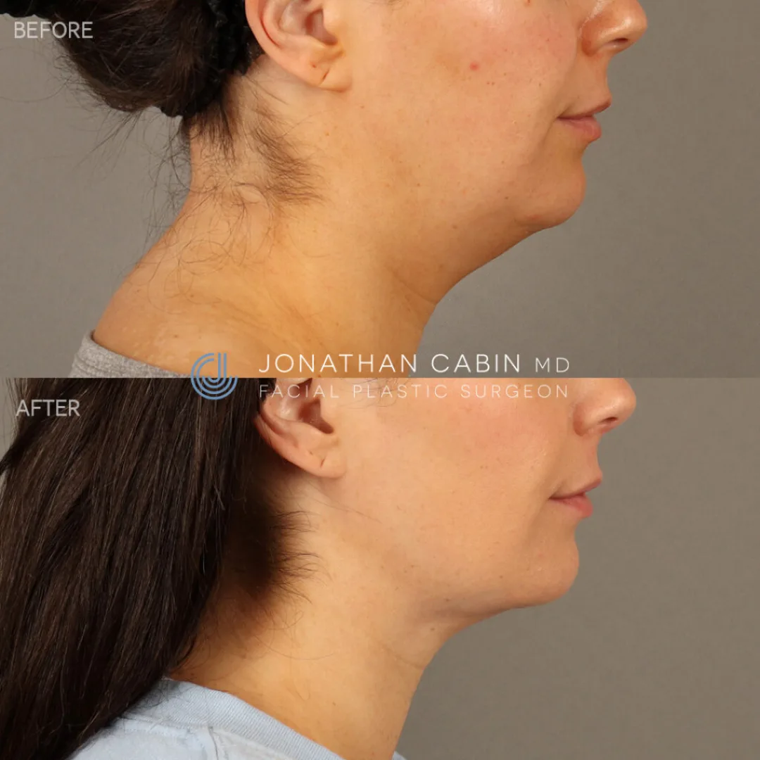 Before and after — Dr. Jonathan Cabin