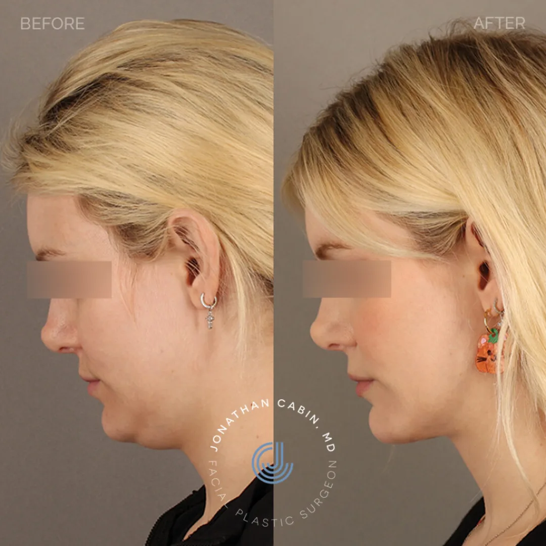 Before and after — Dr. Jonathan Cabin