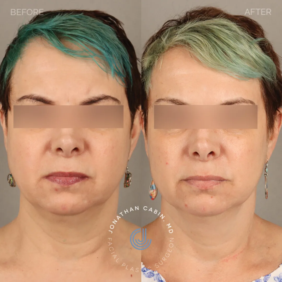 Before and after — Dr. Jonathan Cabin
