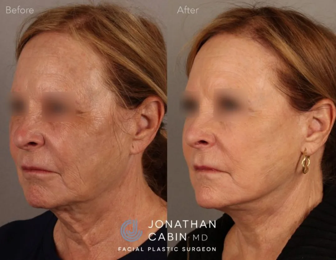 Before and after — Dr. Jonathan Cabin