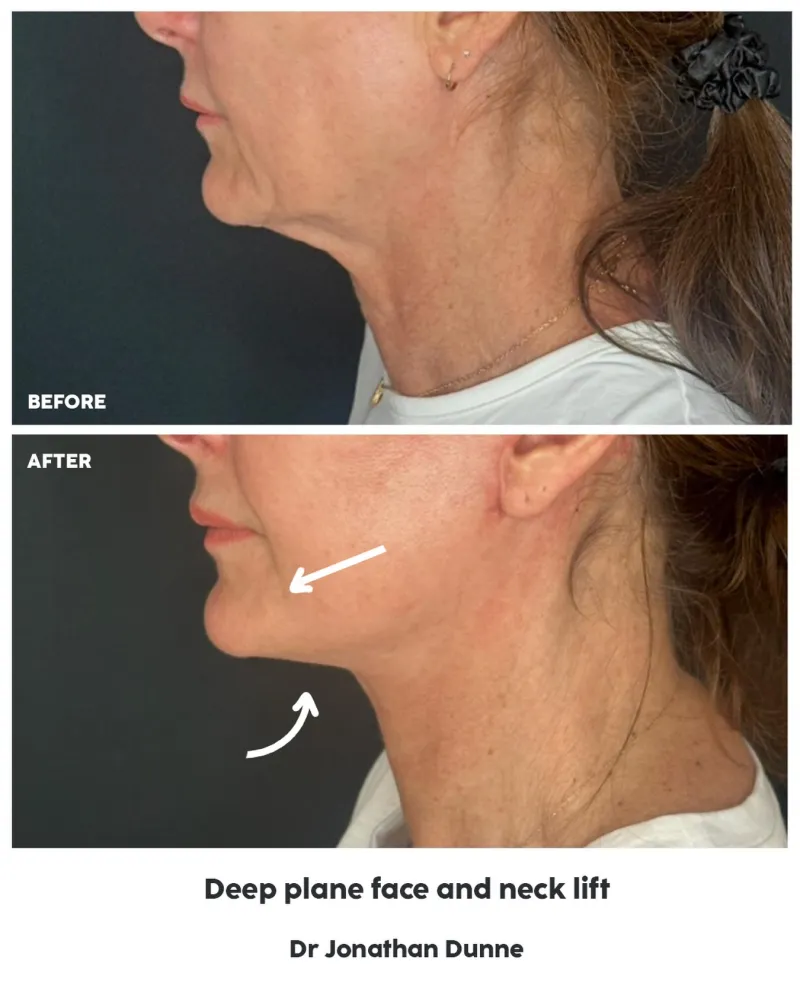 Before and after: Dr. Jonathan Dunne