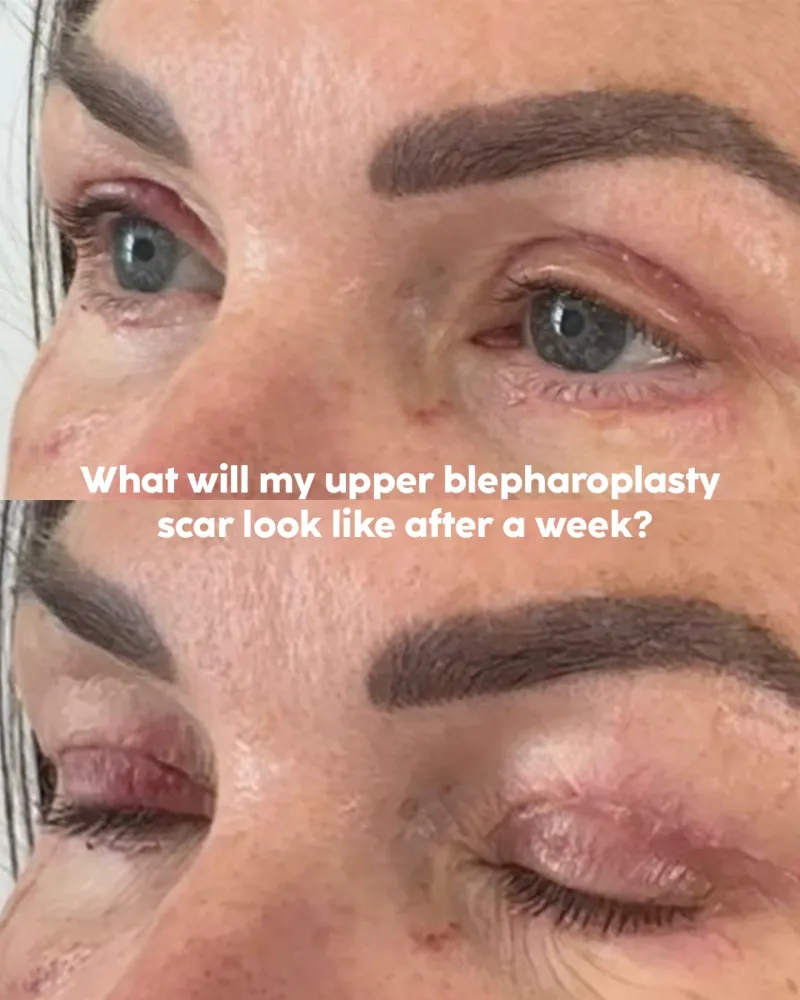 Before and after: Dr. Jonathan Dunne