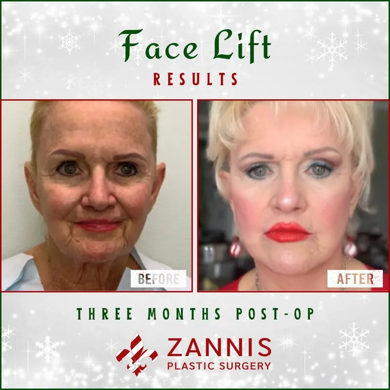 Before and after — Dr. Jonathan Zannis