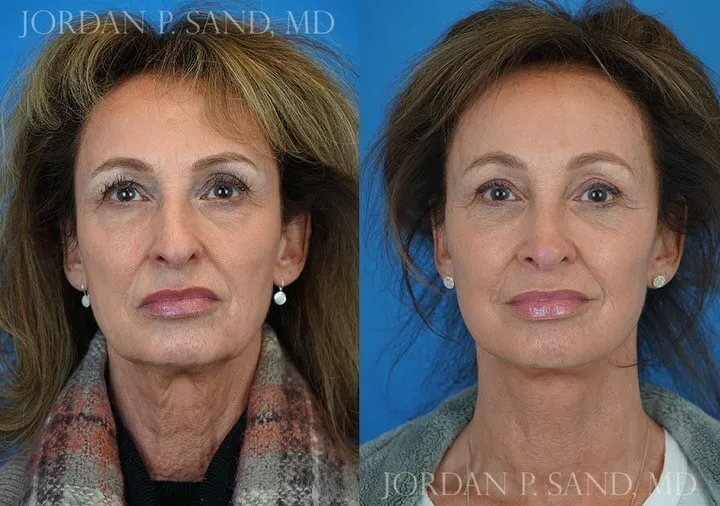 Before and after — Dr. Jordan P. Sand
