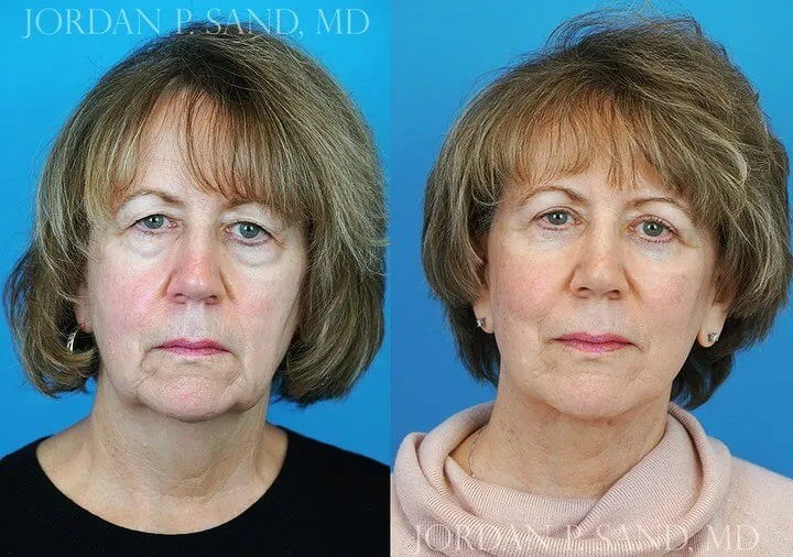 Before and after — Dr. Jordan P. Sand
