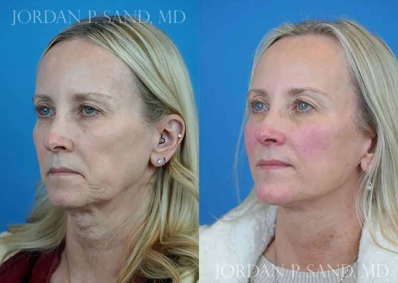 Before and after — Dr. Jordan P. Sand