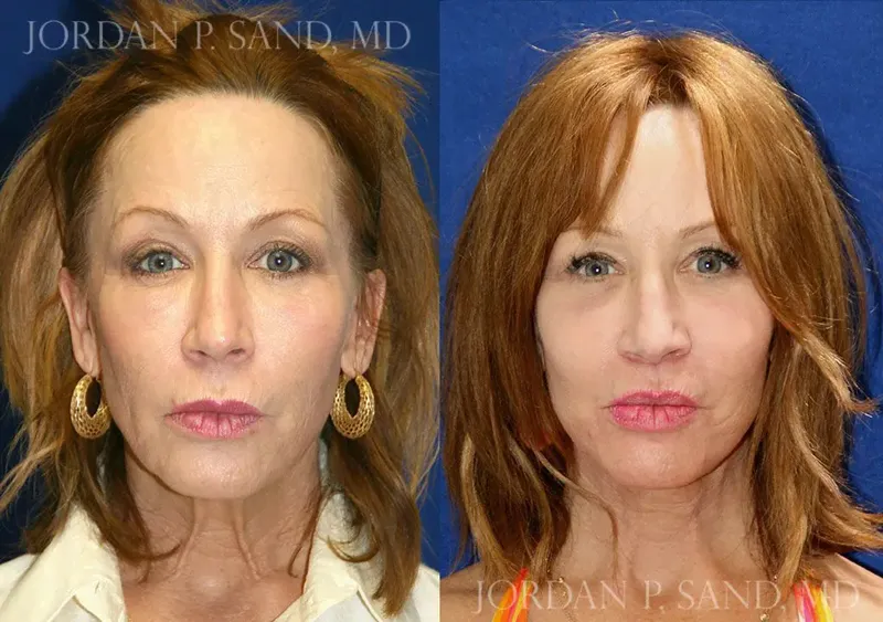 Before and after — Dr. Jordan P. Sand
