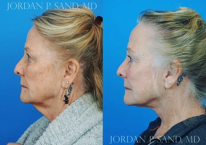 Before and after — Dr. Jordan P. Sand