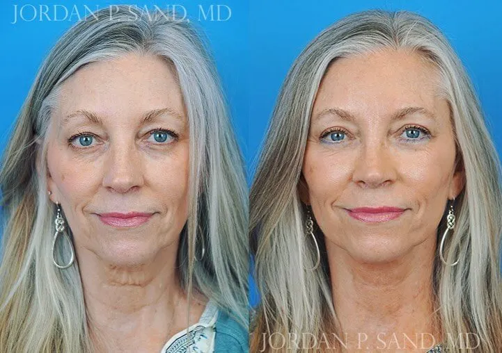 Before and after — Dr. Jordan P. Sand