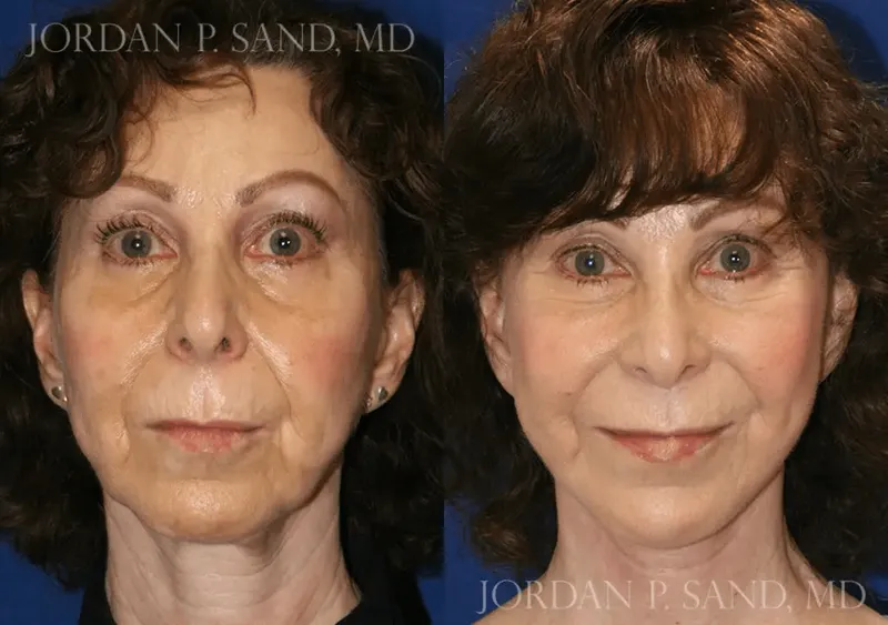 Before and after — Dr. Jordan P. Sand