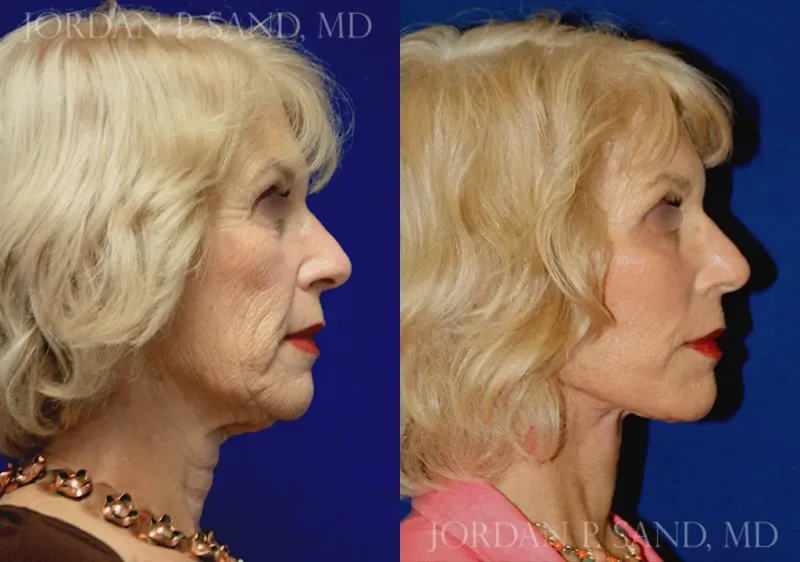 Before and after — Dr. Jordan P. Sand